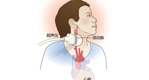 “超”出来的结果，看懂了吗？