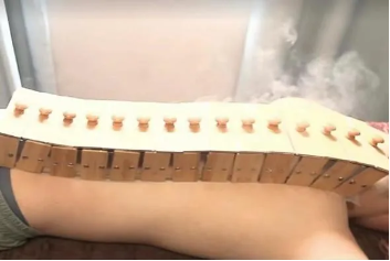 【入伏倒计时】那中医科到底有啥在？刮痧＋归元灸！