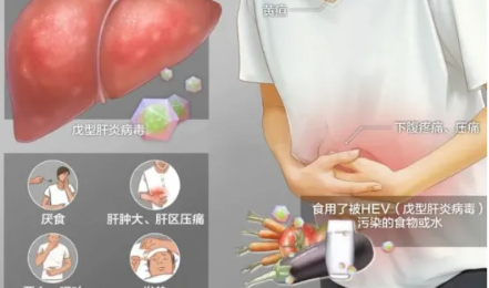 经常外出就餐，竟“吃”出了肝炎